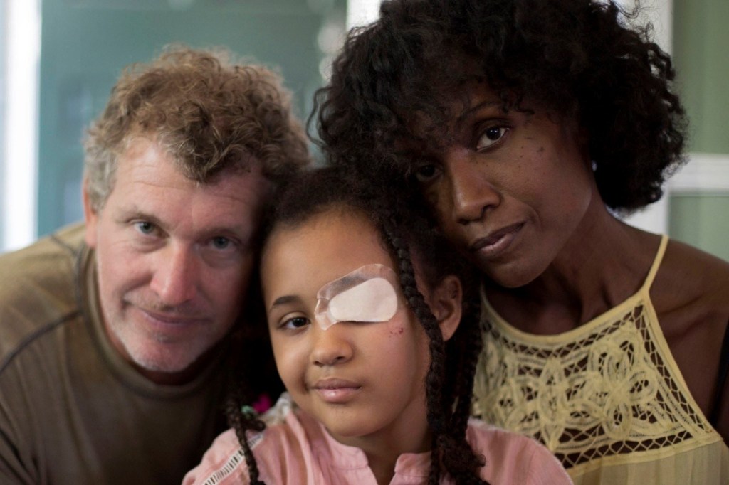 Mom and dad with their daughter with a bandage over her eye